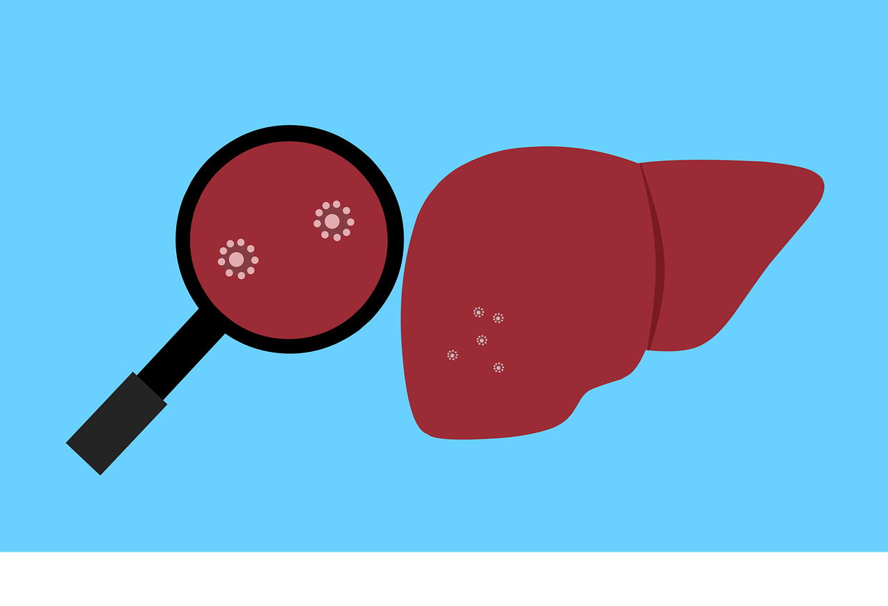 Understanding Hepatitis C: Causes, Symptoms, Treatment