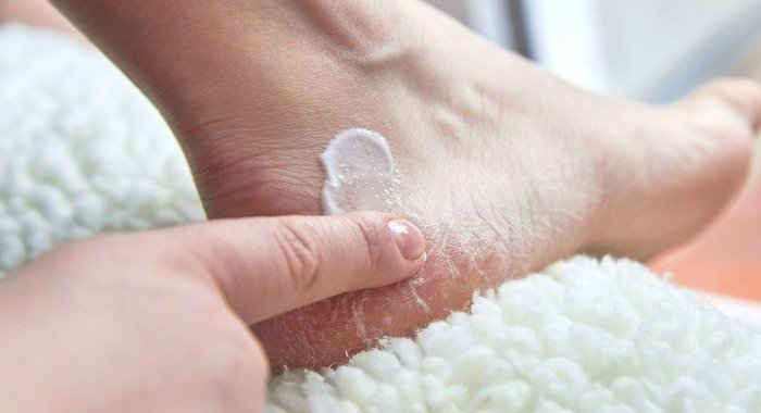A Guide to Antifungal Creams and Ointments