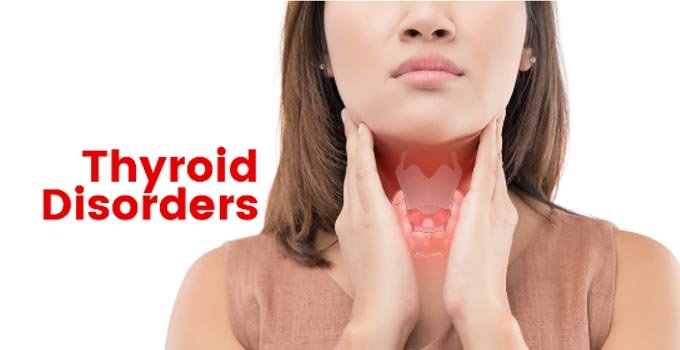 Thyroid Disorders Explained: Symptoms and Treatments