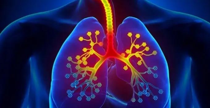 Understanding Asthma: Symptoms, Causes, and Treatments