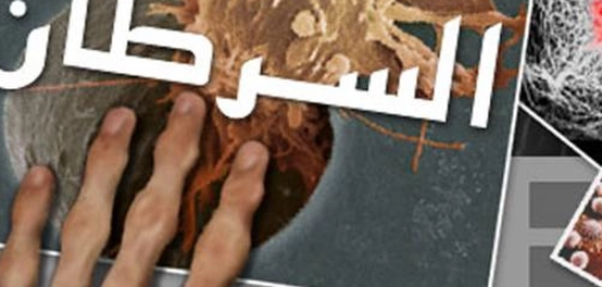 بحث شامل عن مرض السرطان