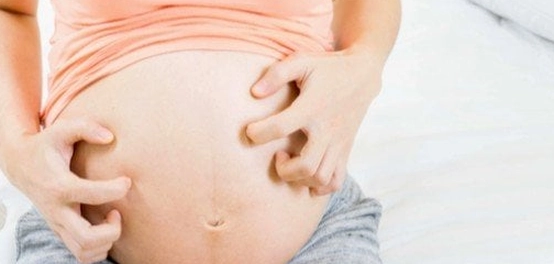 الحكة الجلدية خلال الحمل: الأسباب والعلاج