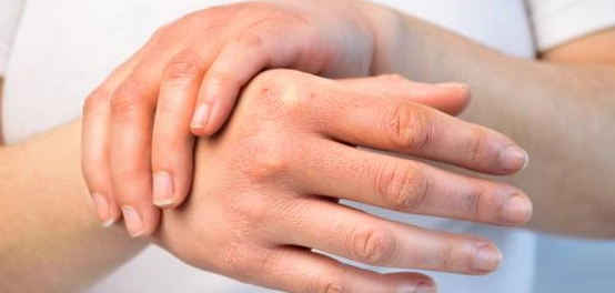 أسباب الحساسية وأنواعها