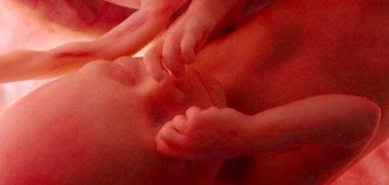 التفاف الحبل السري حول رقبة الجنين: أسبابه ومخاطره
