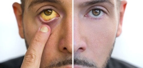 أسباب شحوب الوجه: دليل شامل