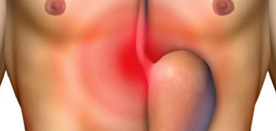 أسباب آلام البطن وعلاجها