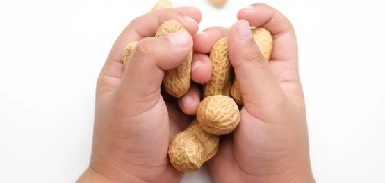 حساسية الطعام لدى الأطفال: دليل شامل للآباء