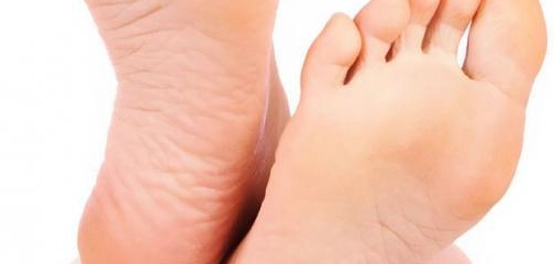 أسباب ارتفاع حرارة الأطراف