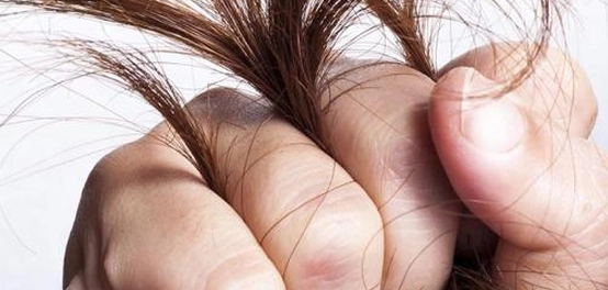 أسباب هشاشة الشعر وكيفية علاجه