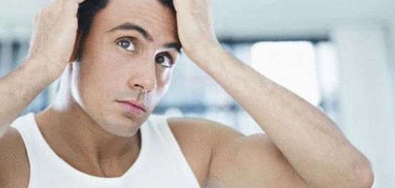 أسباب تساقط شعر الرجال: دليل شامل