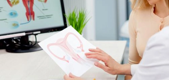 أسباب وعلاج بطانة الرحم المهاجرة