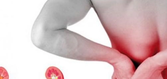 ألم الكلى الحاد: الأسباب، الأعراض، العلاج والوقاية