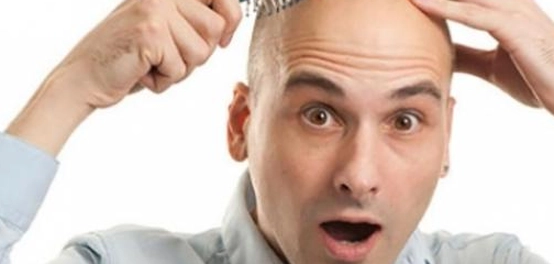 أسباب تساقط الشعر المبكر