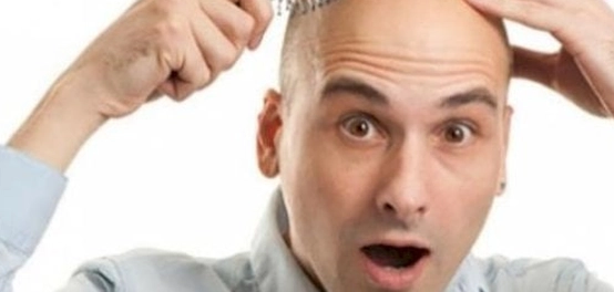 أسباب تساقط الشعر وفقدانه