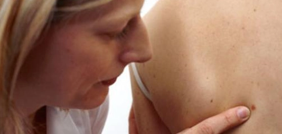 ظهور الحبوب في منطقة الصدر والظهر: الأسباب والحلول
