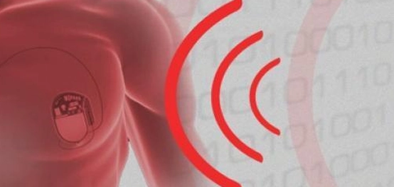 اضطرابات نظم القلب: الأعراض، التشخيص، والعلاج