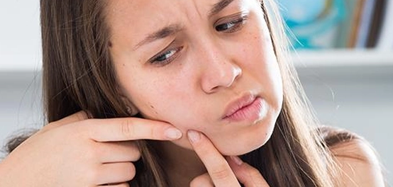 طرق فعالة للتخلص من آثار حب الشباب