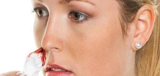 أسباب النزيف الأنفي المفاجئ: دليل شامل