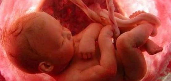 أسباب وفاة الجنين في الأسبوع الثامن