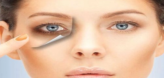 الهالات السوداء: الأسباب والعلاجات الفعّالة