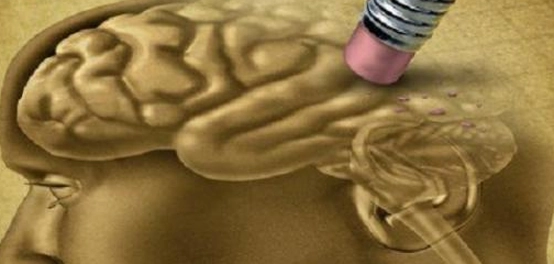 أسباب ضعف الذاكرة وطرق علاجها
