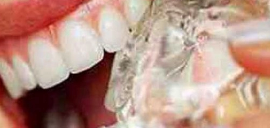 سلبيات الثلج وفوائده: دراسة متوازنة