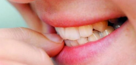 مخاطر عادة قضم الأظافر