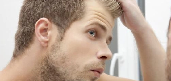 مخاطر وفوائد زراعة الشعر