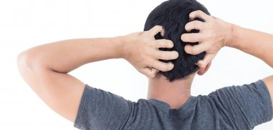 مخاطر خدش فروة الرأس والعناية بها
