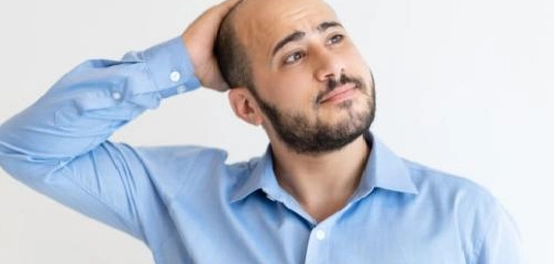 علاج فعال لتساقط الشعر الأمامي