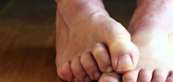 أعراض نقص المغنيسيوم والبوتاسيوم وأسبابهما