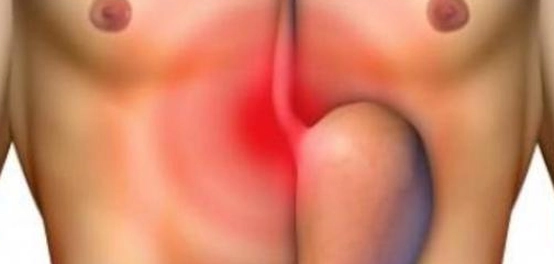 علامات نزيف المعدة: دليل شامل