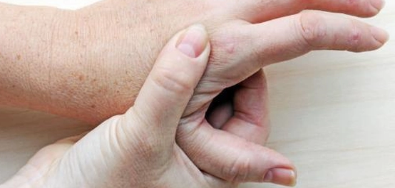 علامات داء النقرس: دليل شامل