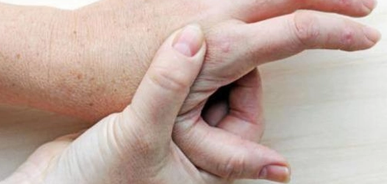 دليل شامل لفهم وعلاج النقرس