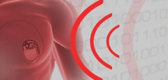 اضطرابات نظم القلب: الأعراض، متى يجب زيارة الطبيب، ومتى حالة طوارئ