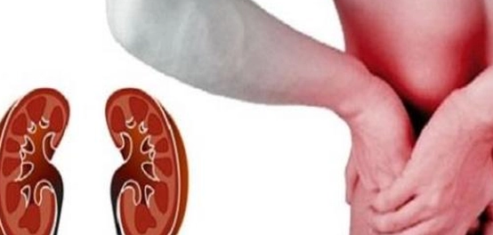 الكلى: وظائفها، أعطالها، وطرق العلاج
