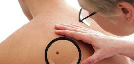 علامات الإنذار المبكرة للسرطان: دليل شامل