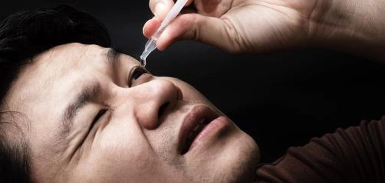 التهاب الملتحمة التحسسي: الأعراض، الأنواع، والعلاج