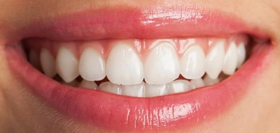 علامات التهاب اللثة وأسبابه وطرق علاجه