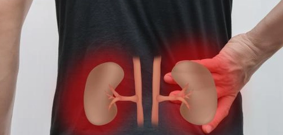 علامات التهاب الكلى وأسبابه ومضاعفاته