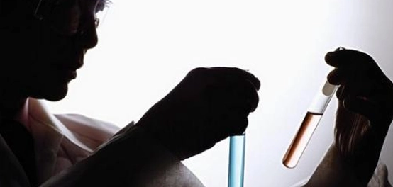 ارتفاع الكرياتينين: الأعراض والأسباب والعلاج