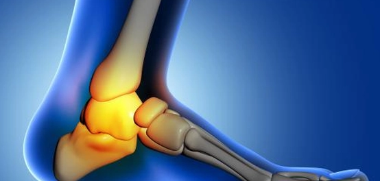 أوجاع كعب القدم: الأسباب، الأعراض، والوقاية