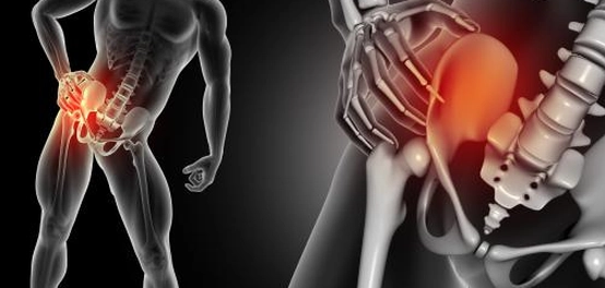 آلام عظام الحوض: الأسباب، الوقاية، والعلاج