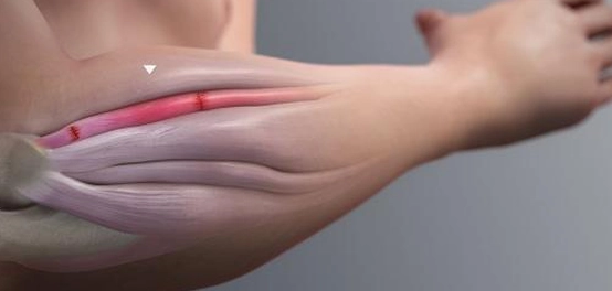 علاج الأمراض بالموجات الصدمية