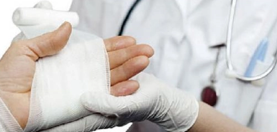 دليل شامل لعلاج الحروق بأنواعها