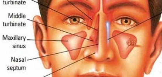 فهم تجاويف الأنف: أنواعها، التهابها، وعلاجها
