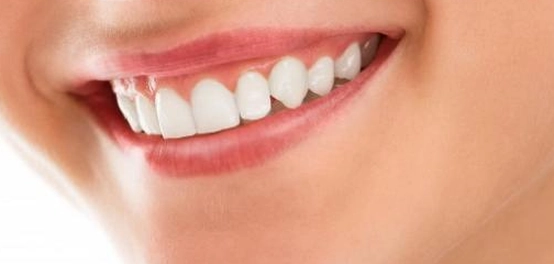 أسرار ابتسامة ساحرة: دليل شامل لتقنيات تجميل الأسنان