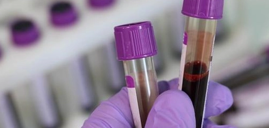 طرق مختلفة لتأكيد الحمل