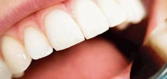 صحة الفم والأسنان: دليل شامل للعناية المثالية