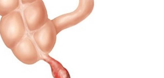 موقع الزائدة الدودية و التهابها